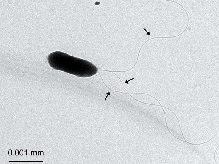 （図１）植物病原菌の電子顕微鏡画像。せん毛と呼ばれる糸状の器官を回転させることで水中を泳ぎ回る。